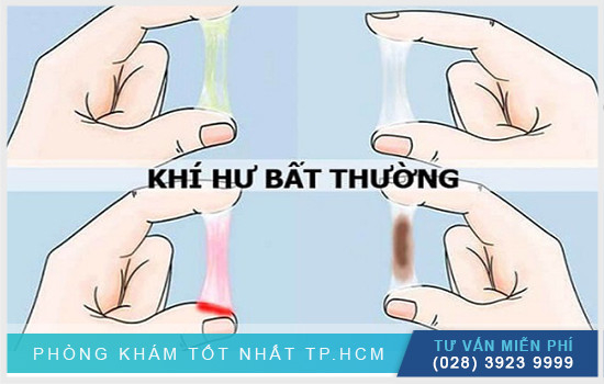 Các thông tin về hình ảnh khí hư