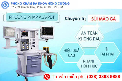 ALA – PDT điều trị sùi mào gà hiệu quả