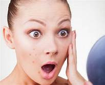 Cách trị mụn trứng cá hiệu quả nhanh nhất chỉ trong 3 ngày
