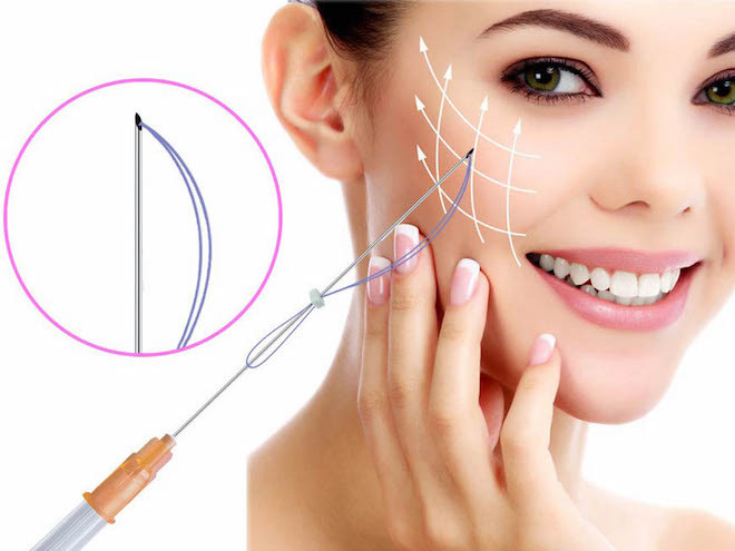 Tiêu chí chọn địa chỉ căng chỉ collagen tốt