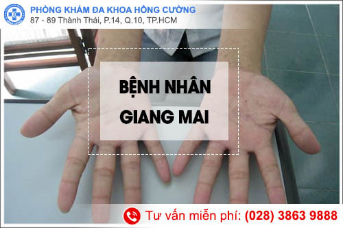 Phòng khám Hồng Cường điều trị bệnh giang mai