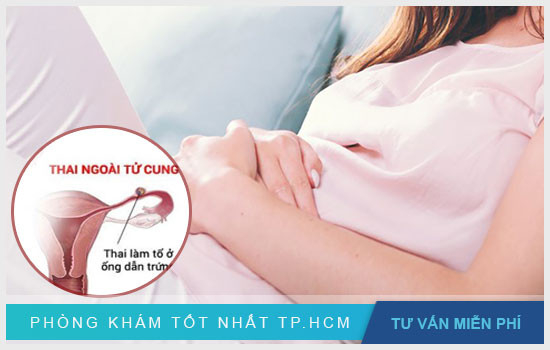 Biến chứng nguy hiểm sau mổ thai ngoài tử cung