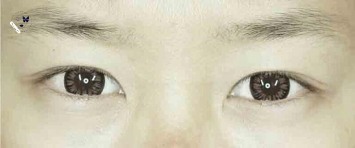 Các dáng lông mày nữ xấu hiện nay - Có nên sửa dáng mày không?
