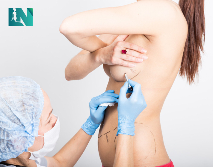 Nâng ngực đẹp và uy tín ở đâu
