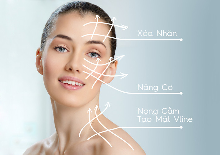 Ưu nhược điểm của phương pháp căng chỉ collagen
